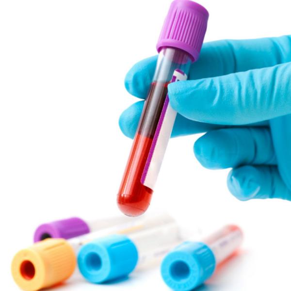 Test tube with blood