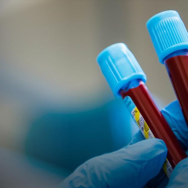 Vials of blood held by a blue-gloved hand